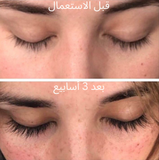 The Ordinary – Sérum pour les Cils ( 1 produit = 6 mois d’utilisation )