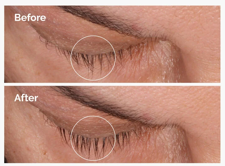 The Ordinary – Sérum pour les Cils ( 1 produit = 6 mois d’utilisation )